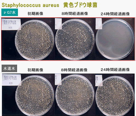 黄色ブドウ球菌とVG7量子水